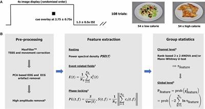 A Longitudinal Magnetoencephalographic Study of the Effects of Deep Brain Stimulation on Neuronal Dynamics in Severe Anorexia Nervosa